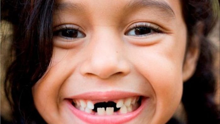 Mơ thấy răng rụng đánh con gì? Giải mã giấc mơ thấy răng rụng