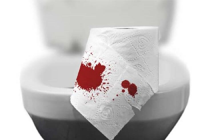 Mơ thấy đi cầu ra máu nhưng không đau